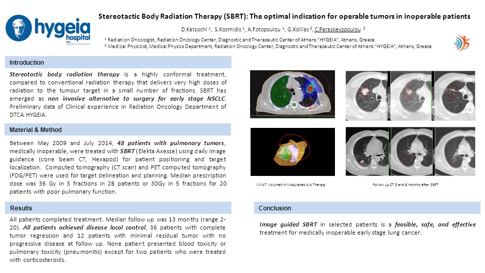 Stereotactic Body Radiation Therapy (SBRT): The optimal indication for operable tumors in inoperable patients D.Katsochi 1, S.Kosmidis 1, A.Fotopoulou 1, G.Kollias 2, C.Paraskevopoulou 2 Introduction Material & Method ResultsConclusion 1 Radiation Oncologist, Radiation Oncology Center, Diagnostic and Therapeutic Center of Athens HYGEIA , Athens, Greece 2 Medical Physicist, Medical Physics Department, Radiation Oncology Center, Diagnostic and Therapeutic Center of Athens HYGEIA , Athens, Greece Stereotactic body radiation therapy is a highly conformal treatment, compared to conventional radiation therapy that delivers very high doses of radiation to the tumour target in a small number of fractions.