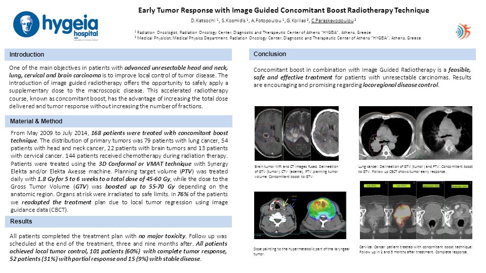 Early Tumor Response with Image Guided Concomitant Boost Radiotherapy Technique D.Katsochi 1, S.Kosmidis 1, A.Fotopoulou 1, G.Kollias 2, C.Paraskevopoulou 2 Introduction Material & Method Results Conclusion 1 Radiation Oncologist, Radiation Oncology Center, Diagnostic and Therapeutic Center of Athens HYGEIA , Athens, Greece 2 Medical Physicist, Medical Physics Department, Radiation Oncology Center, Diagnostic and Therapeutic Center of Athens HYGEIA , Athens, Greece One of the main objectives in patients with advanced unresectable head and neck, lung, cervical and brain carcinoma is to improve local control of tumor disease.