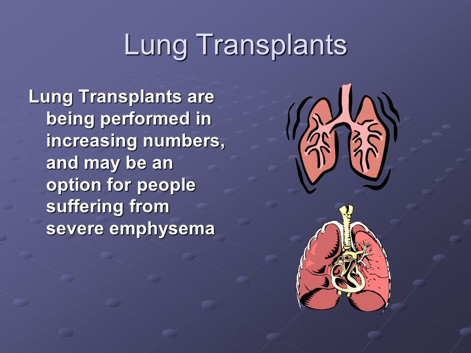 Lung Transplants Lung Transplants are being performed in increasing numbers, and may be an option for people suffering from severe emphysema