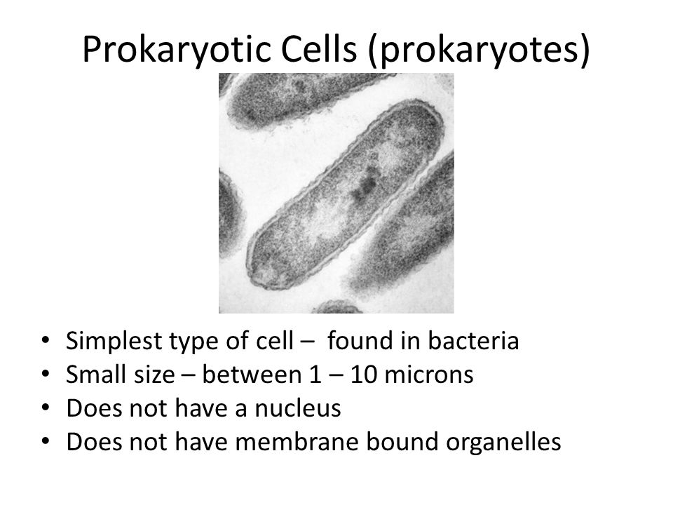 Prokaryotic Cells (prokaryotes) Simplest type of cell – found in bacteria Small size – between 1 – 10 microns Does not have a nucleus Does not have membrane bound organelles