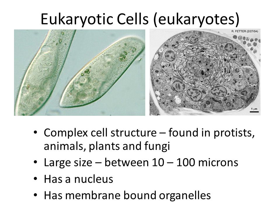 Eukaryotic Cells (eukaryotes) Complex cell structure – found in protists, animals, plants and fungi Large size – between 10 – 100 microns Has a nucleus Has membrane bound organelles