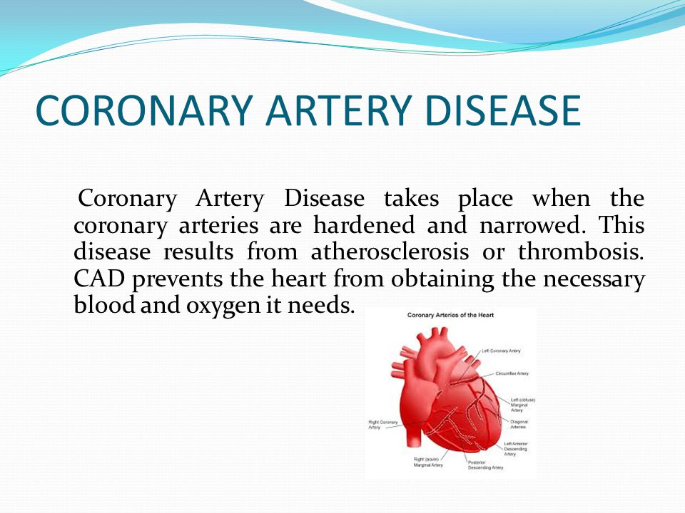 CORONARY ARTERY DISEASE Coronary Artery Disease takes place when the coronary arteries are hardened and narrowed.