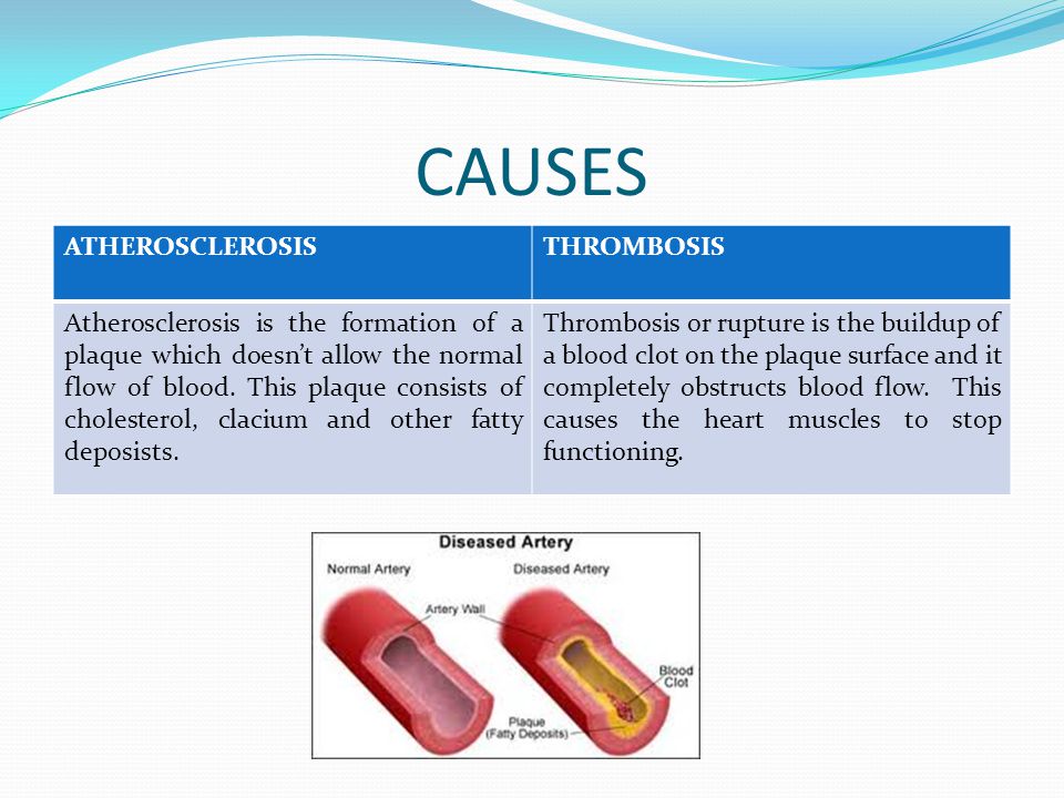 CAUSES ATHEROSCLEROSISTHROMBOSIS Atherosclerosis is the formation of a plaque which doesn’t allow the normal flow of blood.