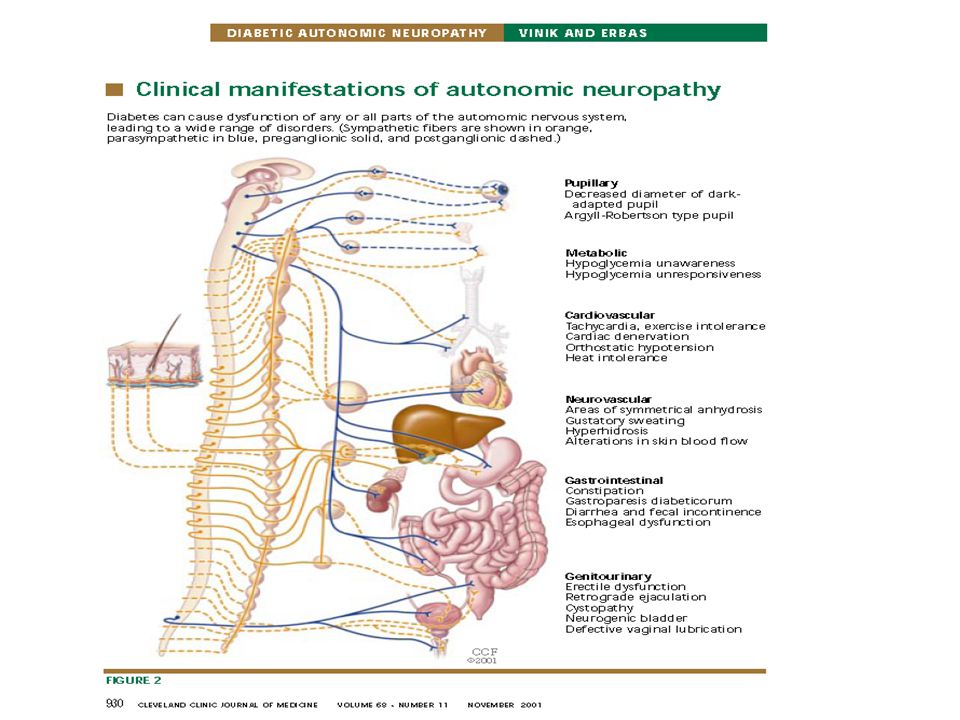 Cardiac autonomic neuropathy