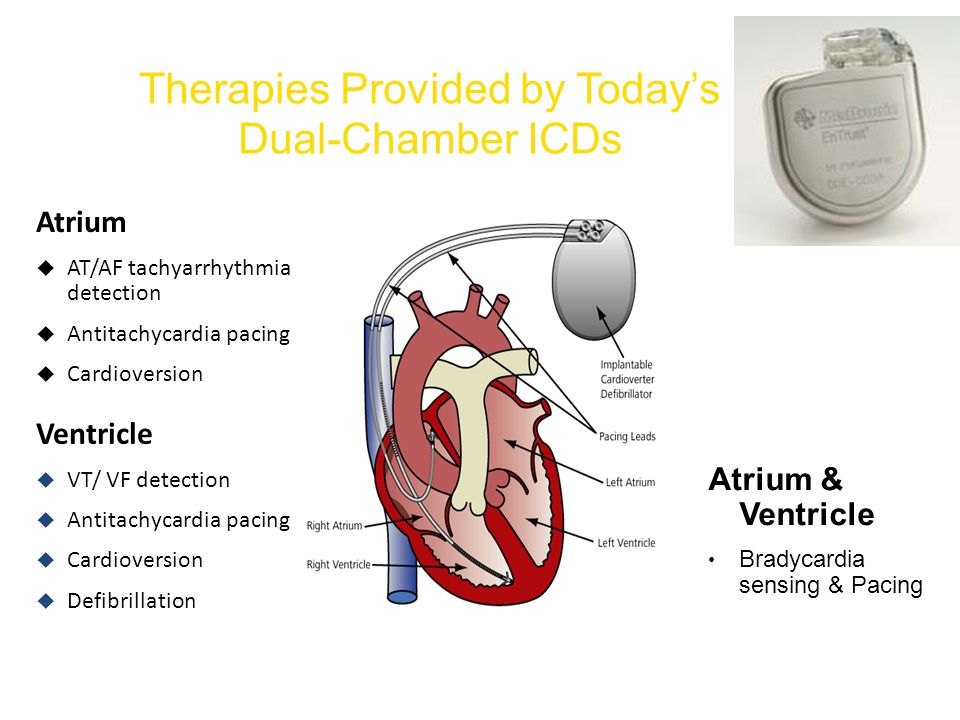 Atrium & Ventricle Bradycardia sensing & Pacing Atrium  AT/AF tachyarrhythmia detection  Antitachycardia pacing  Cardioversion Ventricle  VT/ VF detection  Antitachycardia pacing  Cardioversion  Defibrillation Therapies Provided by Today’s Dual-Chamber ICDs