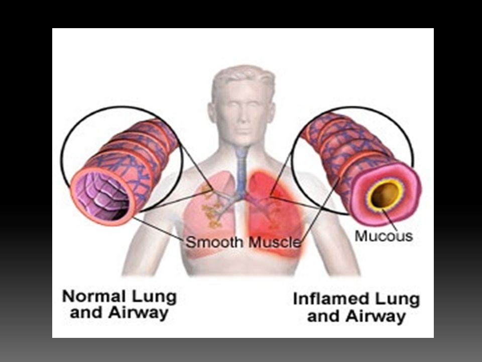 the bronchial tubes or bronchi connect the windpipe to the lungs how does mucus form