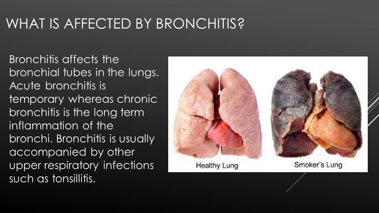 respiratory disease Repeated and long-term exposure to certain irritants on the job can lead to an array of lung diseases that may have lasting effects, even after exposure ceases. respiratory disease Repeated and long-term exposure to certain irritants on the job can lead to an array of lung diseases that may have lasting effects, even after exposure ceases.