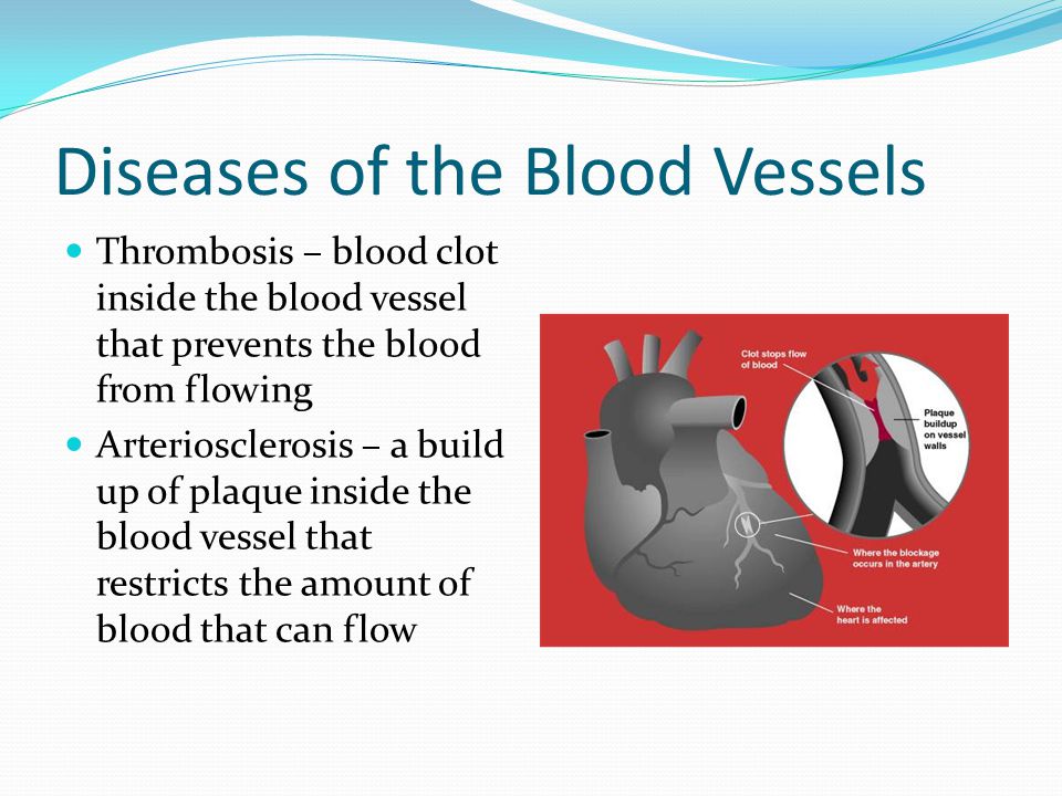 Diseases of the Blood Vessels Thrombosis – blood clot inside the blood vessel that prevents the blood from flowing Arteriosclerosis – a build up of plaque inside the blood vessel that restricts the amount of blood that can flow