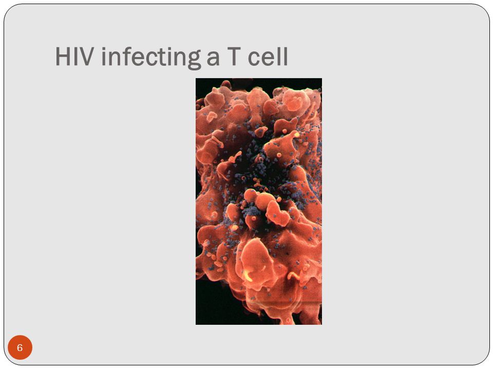 HIV infecting a T cell 6
