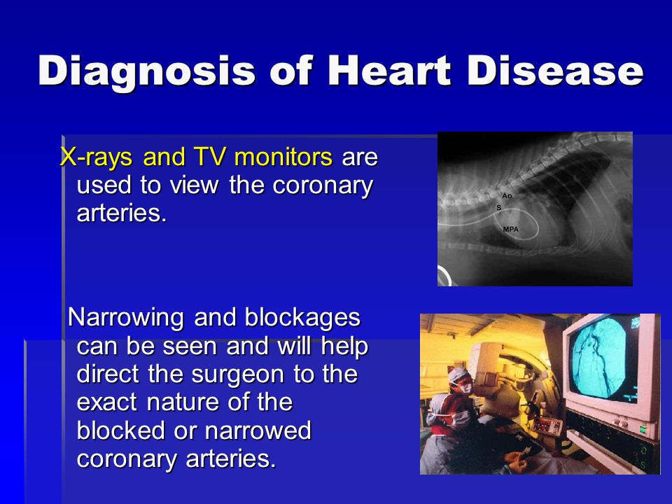 Diagnosis of Heart Disease X-rays and TV monitors are used to view the coronary arteries.