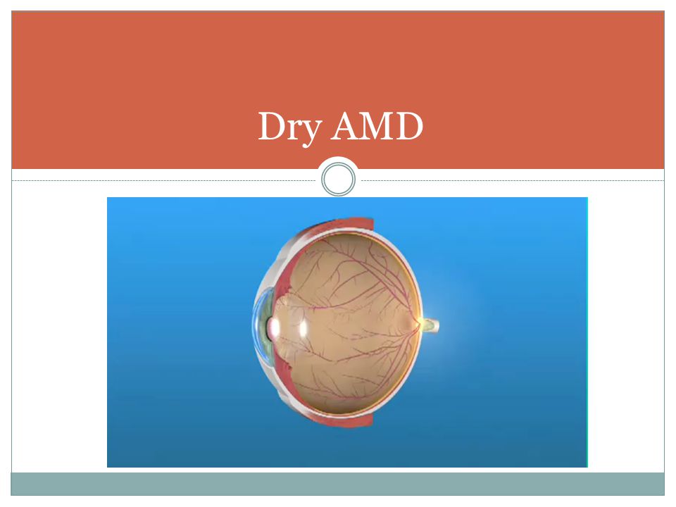 Dry AMD