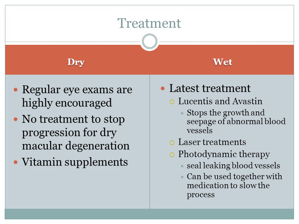 Dry Wet Regular eye exams are highly encouraged No treatment to stop progression for dry macular degeneration Vitamin supplements Latest treatment  Lucentis and Avastin  Stops the growth and seepage of abnormal blood vessels  Laser treatments  Photodynamic therapy  seal leaking blood vessels  Can be used together with medication to slow the process Treatment