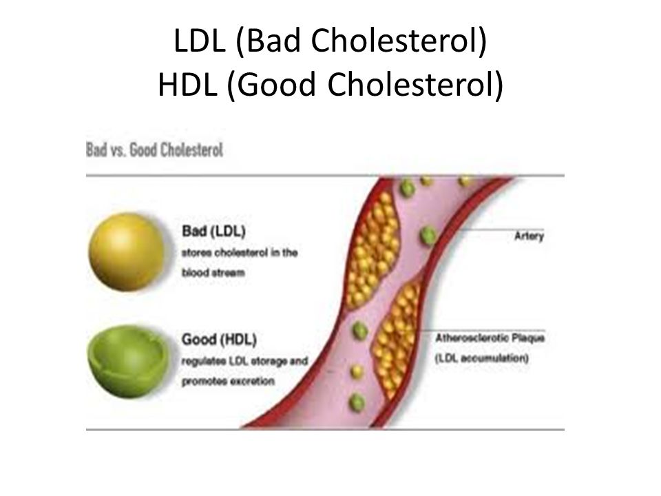LDL (Bad Cholesterol) HDL (Good Cholesterol)