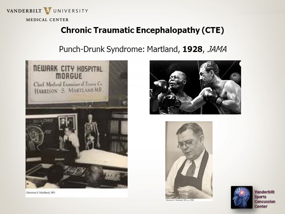 Chronic Traumatic Encephalopathy (CTE) Punch-Drunk Syndrome: Martland, 1928, JAMA