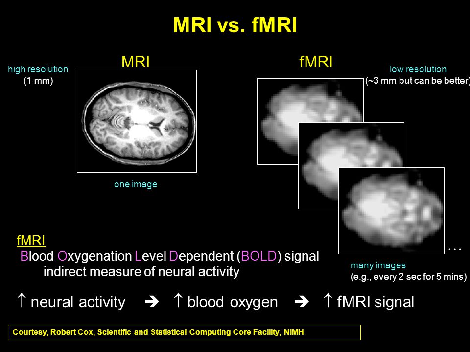 functional mri