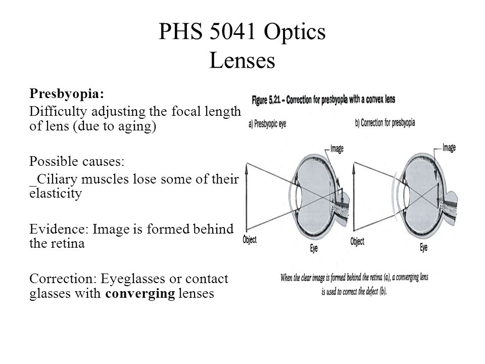 PHS 5041 Optics Lenses Presbyopia: Difficulty adjusting the focal length of lens (due to aging) Possible causes: _Ciliary muscles lose some of their elasticity Evidence: Image is formed behind the retina Correction: Eyeglasses or contact glasses with converging lenses