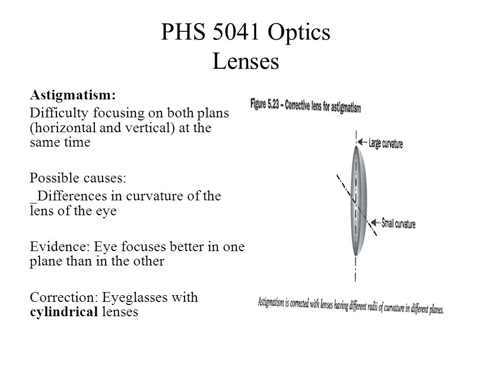 PHS 5041 Optics Lenses Astigmatism: Difficulty focusing on both plans (horizontal and vertical) at the same time Possible causes: _Differences in curvature of the lens of the eye Evidence: Eye focuses better in one plane than in the other Correction: Eyeglasses with cylindrical lenses