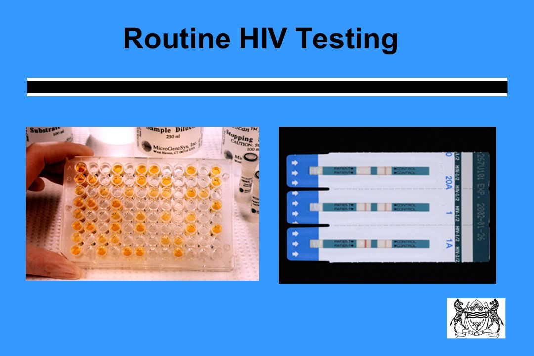 Routine HIV Testing
