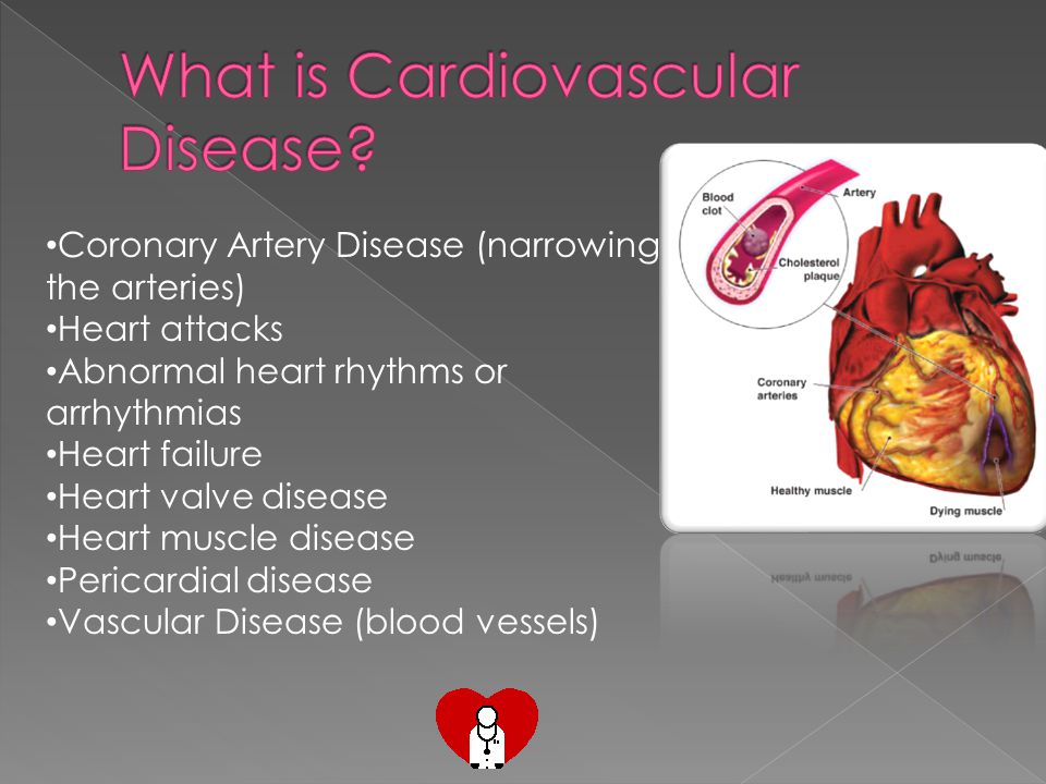 Coronary Artery Disease (narrowing the arteries) Heart attacks Abnormal heart rhythms or arrhythmias Heart failure Heart valve disease Heart muscle disease Pericardial disease Vascular Disease (blood vessels)