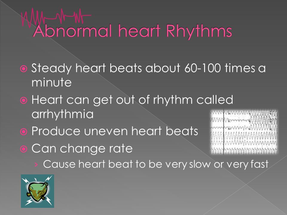  Steady heart beats about times a minute  Heart can get out of rhythm called arrhythmia  Produce uneven heart beats  Can change rate › Cause heart beat to be very slow or very fast