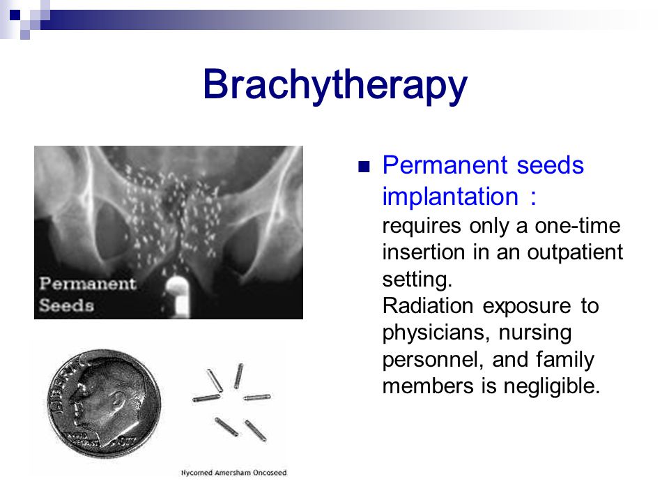 Brachytherapy Permanent seeds implantation : requires only a one-time insertion in an outpatient setting.
