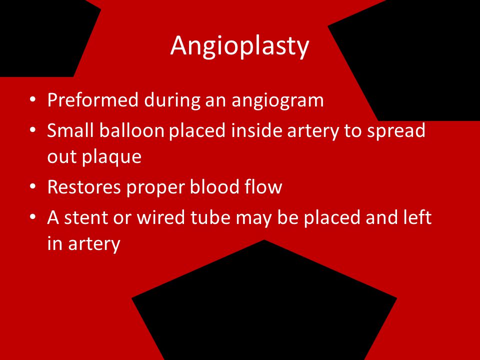 Angiogram Catheter inserted into by an incision in the arm or groin Internal view of the heart One-Two Hours Long Your Awake during the test More on Coronary Angiogram