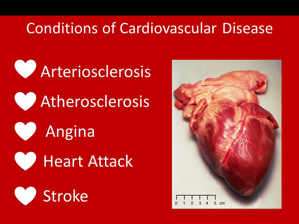 Coronary Artery Disease Coronary Artery Disease Video