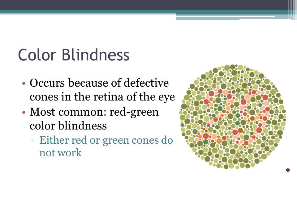 Color Blindness Occurs because of defective cones in the retina of the eye Most common: red-green color blindness ▫Either red or green cones do not work