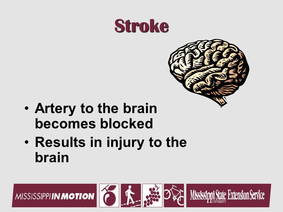 Stroke Artery to the brain becomes blocked Results in injury to the brain