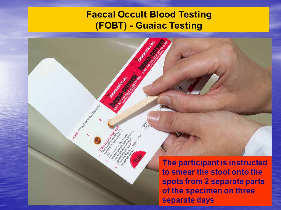 Faecal Occult Blood Testing (FOBT) - Guaiac Testing The participant is instructed to smear the stool onto the spots from 2 separate parts of the specimen on three separate days