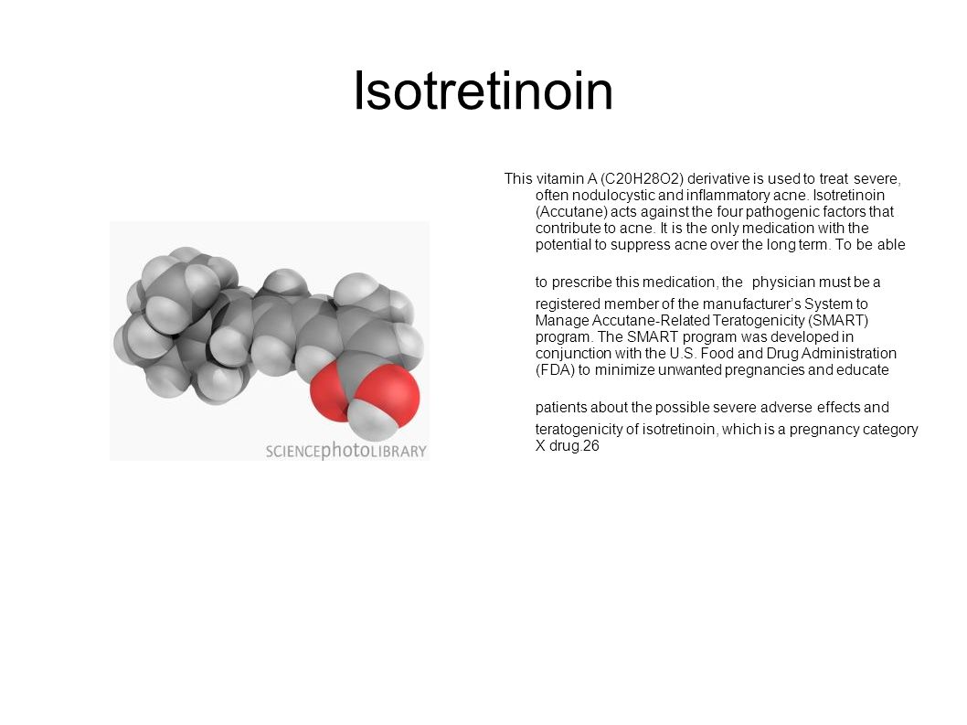 Accutane Teratogen