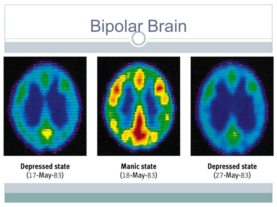 Bipolar sex addiction symptoms