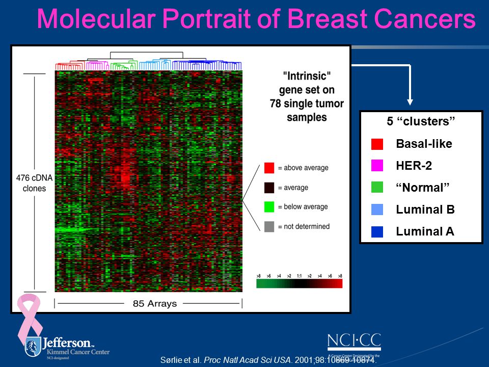 Molecular Portrait of Breast Cancers Sørlie et al.