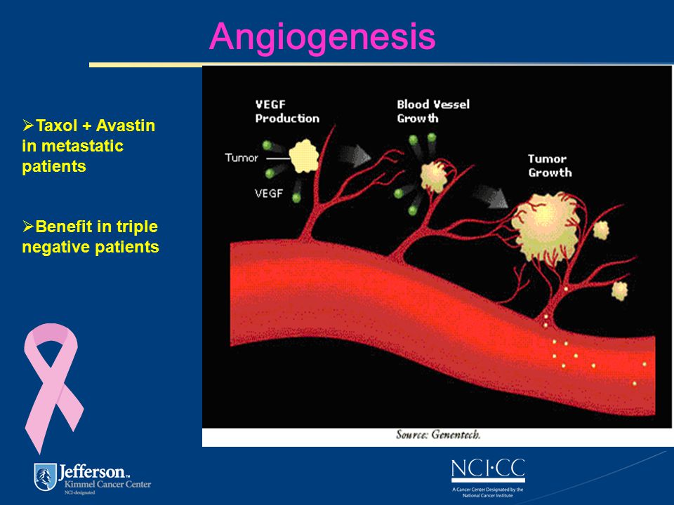 Angiogenesis  Taxol + Avastin in metastatic patients  Benefit in triple negative patients