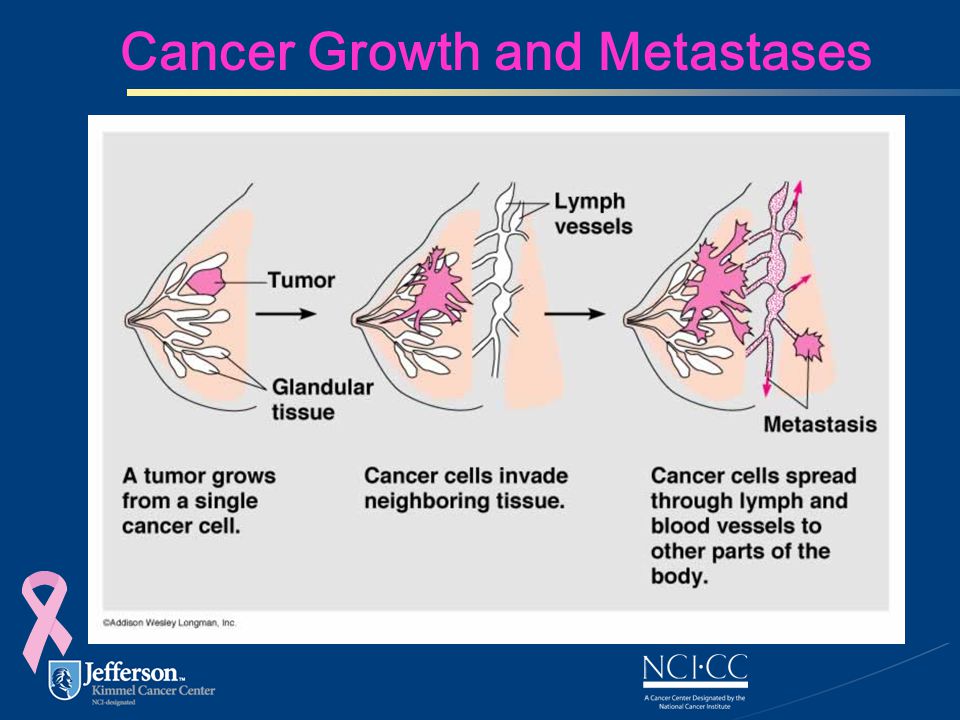Cancer Growth and Metastases