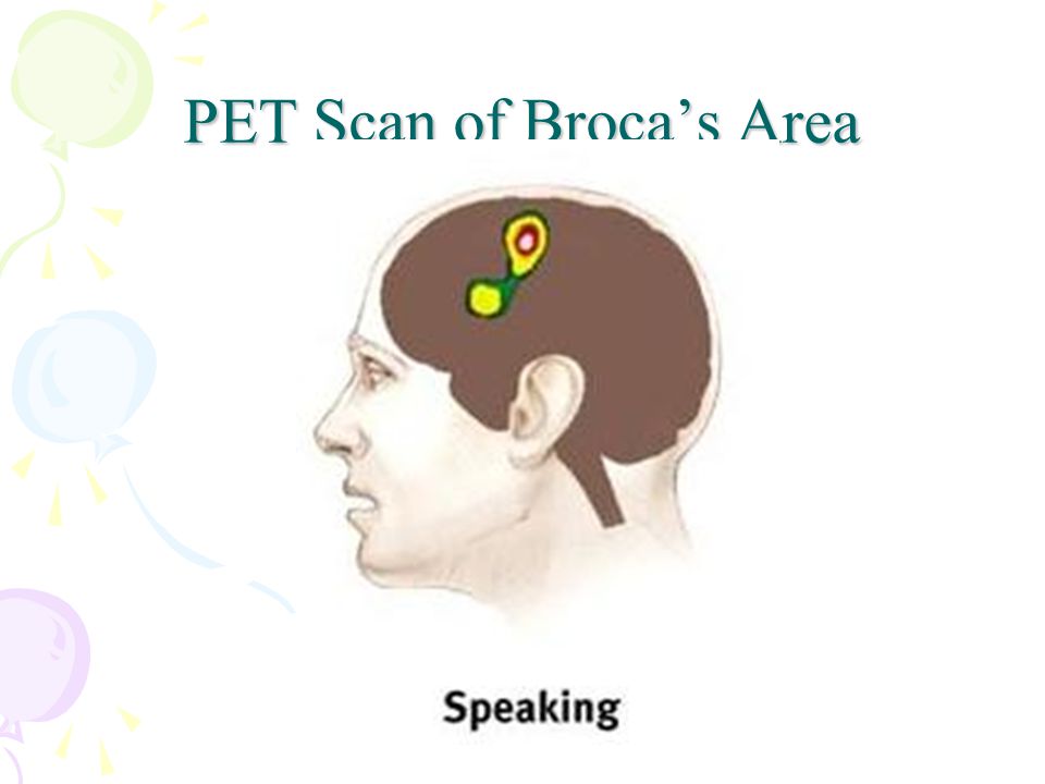PET Scan of Broca’s Area