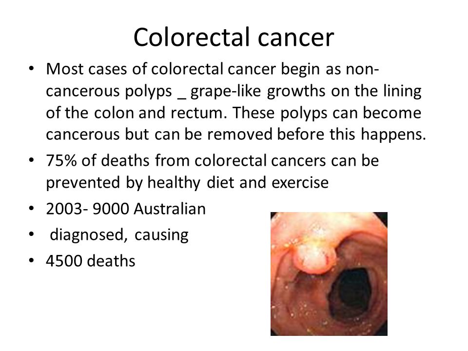 Colorectal cancer Most cases of colorectal cancer begin as non- cancerous polyps _ grape-like growths on the lining of the colon and rectum.