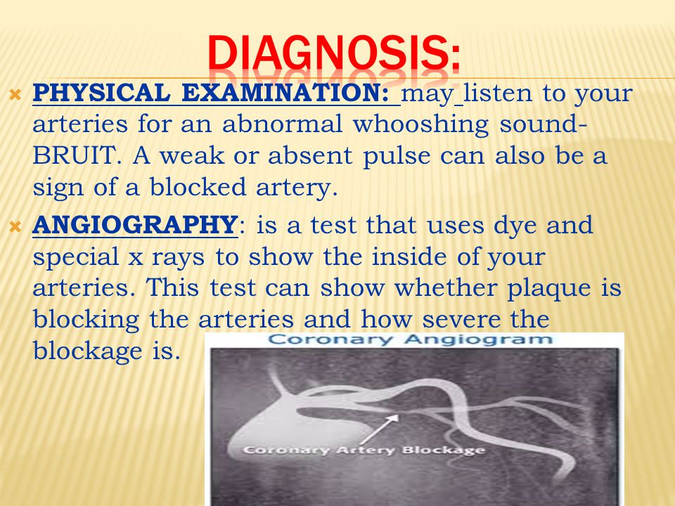  PHYSICAL EXAMINATION: may listen to your arteries for an abnormal whooshing sound- BRUIT.