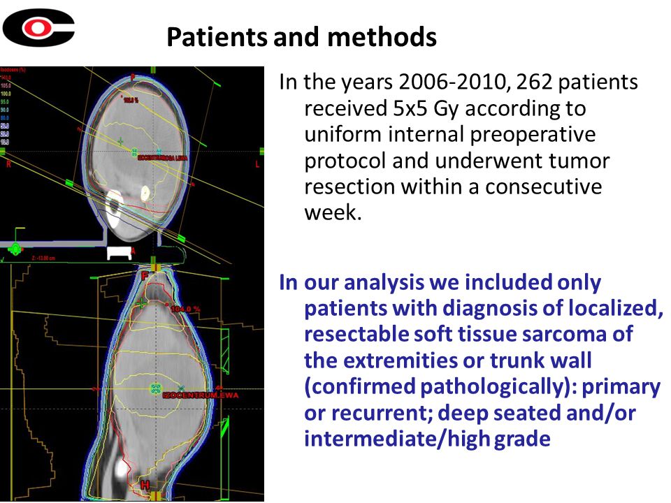 Patients and methods In the years , 262 patients received 5x5 Gy according to uniform internal preoperative protocol and underwent tumor resection within a consecutive week.