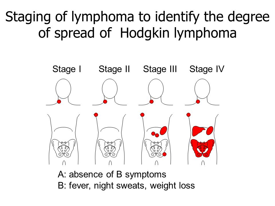 Adult non hodgkins lymphoma