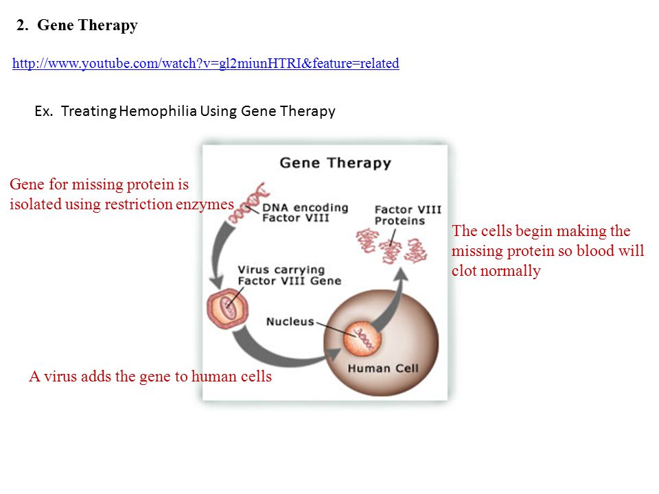 2. Gene Therapy   v=gl2miunHTRI&feature=related Ex.