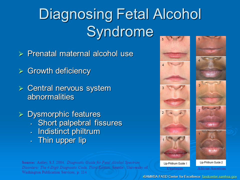 fetal alcohol syndrome disorder (june 2014) facts about fetal alcohol spectrum disorders (fasds) alcohol is a teratogen, which is a substance that causes developmental malformations in an embryo or fetus. fetal alcohol syndrome disorder (june 2014) facts about fetal alcohol spectrum disorders (fasds) alcohol is a teratogen, which is a substance that causes developmental malformations in an embryo or fetus.