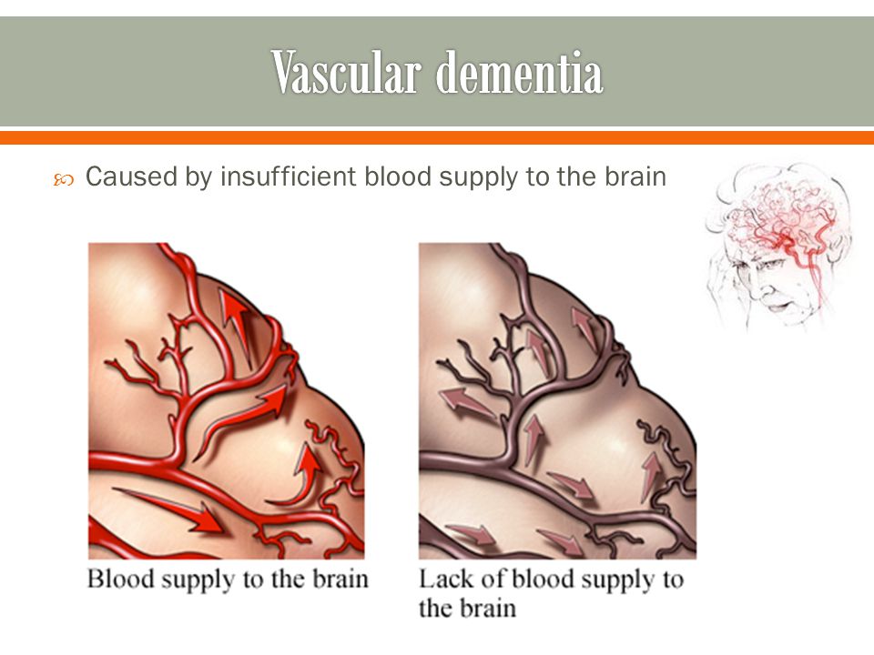  Caused by insufficient blood supply to the brain