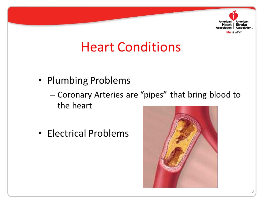 Heart Conditions Plumbing Problems – Coronary Arteries are pipes that bring blood to the heart Electrical Problems 3