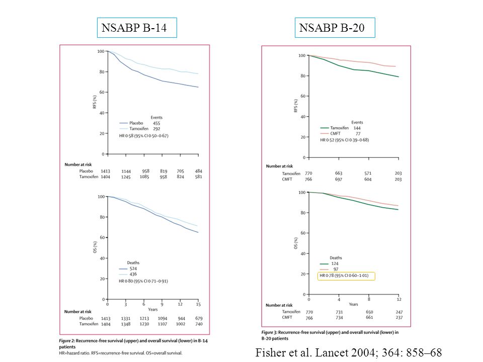 NSABP B-14NSABP B-20 Fisher et al. Lancet 2004; 364: 858–68