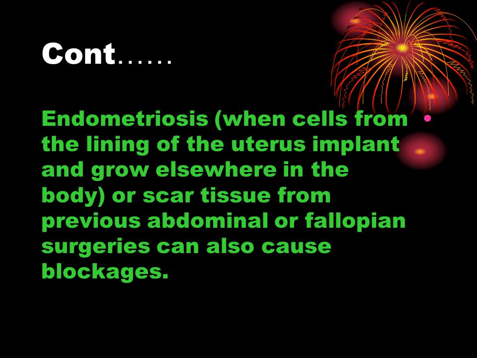 Cont …… Endometriosis (when cells from the lining of the uterus implant and grow elsewhere in the body) or scar tissue from previous abdominal or fallopian surgeries can also cause blockages.