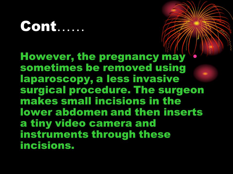 Cont …… However, the pregnancy may sometimes be removed using laparoscopy, a less invasive surgical procedure.