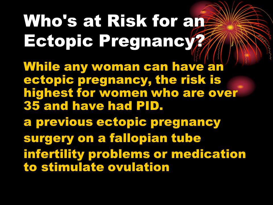 Who s at Risk for an Ectopic Pregnancy.
