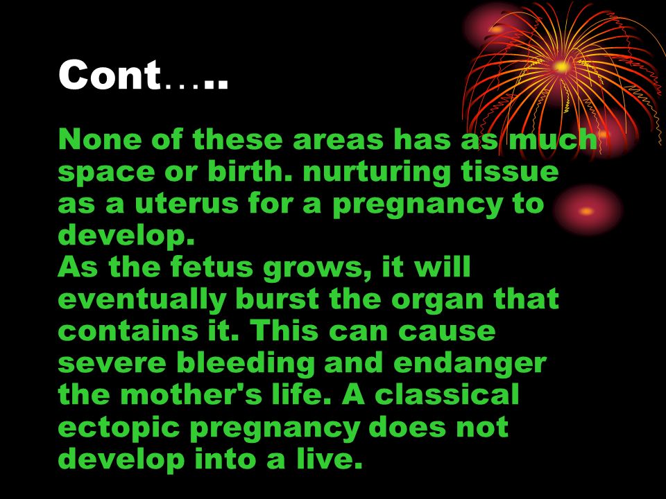 Cont ….. None of these areas has as much space or birth.