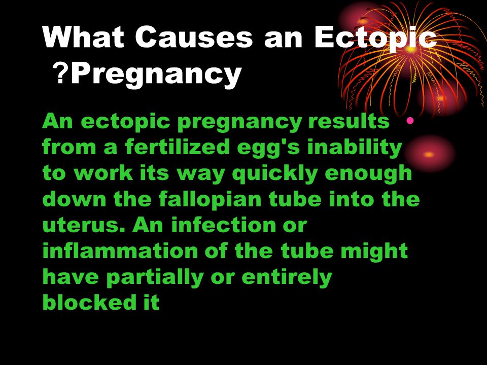 What Causes an Ectopic Pregnancy.